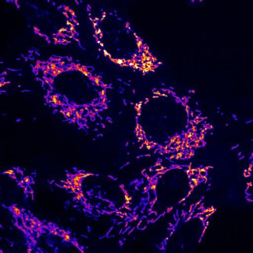 Parkinson’s disease: When molecular guardians need to be protected