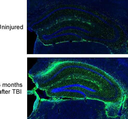 Complement inhibition reverses mental losses in preclinical traumatic brain injury models