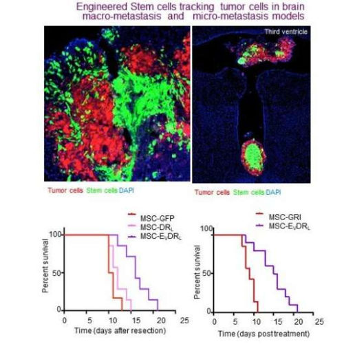 Engineered ‘off the shelf’ stem cells target breast cancer that metastasizes to the brain