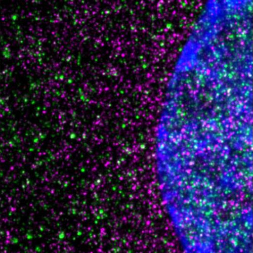 Huntington’s disease driven by slowed protein-building machinery in cells