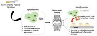 Study finds inflammatory mechanism responsible for bone erosion in rheumatoid arthritis