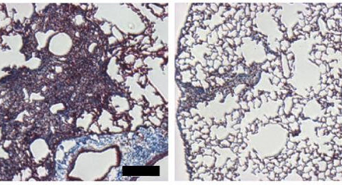 Targeting mechanosensitive protein could treat pulmonary fibrosis, study suggests