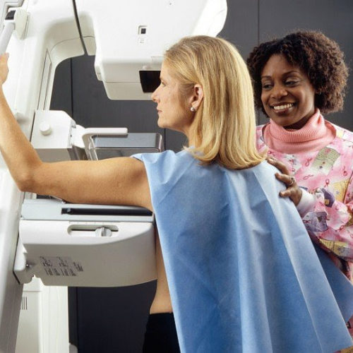 Changes can be detected in BRCA1 breast cells before they turn cancerous