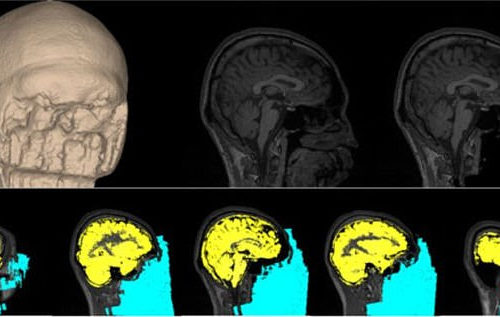 Born a coward? Scientists have found a way to zap the BRAIN to boost your courage and remove fear