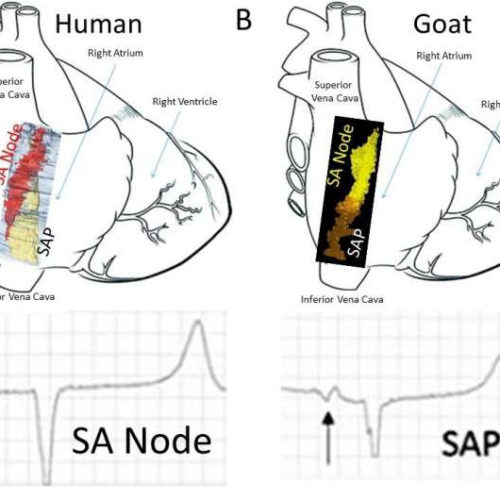 Researchers discover a backup natural pacemaker in the heart