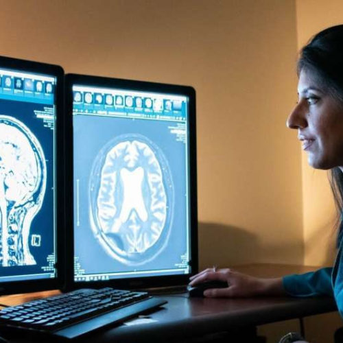 New radiology research shows promising results for focused ultrasound treatment of Alzheimer’s