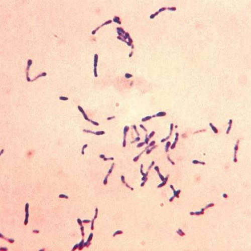 Diphtheria risks becoming major global threat again as it evolves antimicrobial resistance