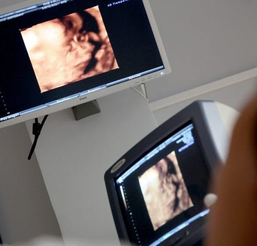 Ultrasound may have potential for treating pain after chemotherapy