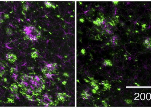 Potential drug for Alzheimer’s disease prevention found safe and effective in animals