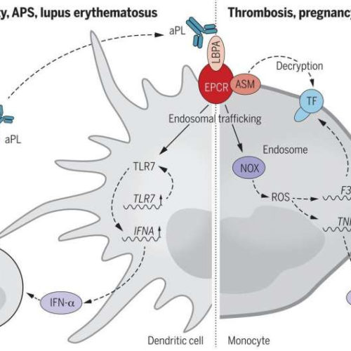 Antiphospholipid syndrome breakthrough: Cell-surface targets identified, opening path to therapies