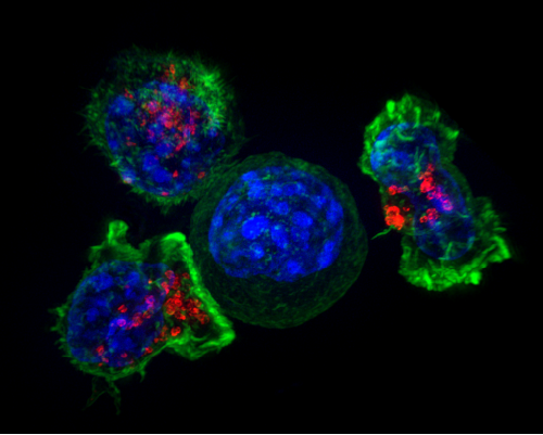 Drug testing approach uncovers effective combination for treating small cell lung cancer