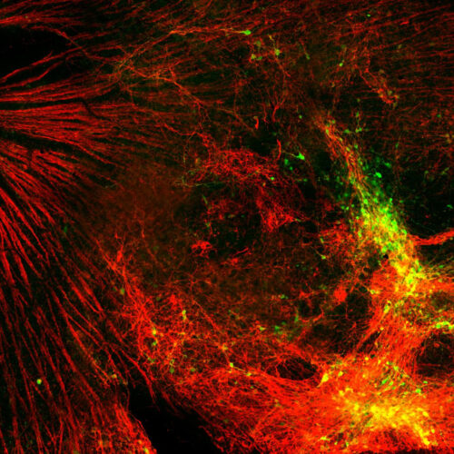 MIPT and Harvard researchers grow stem cells to cure glaucoma