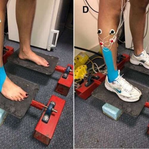 Sports stars’ kinesiology tape injury treatment makes ‘no difference’