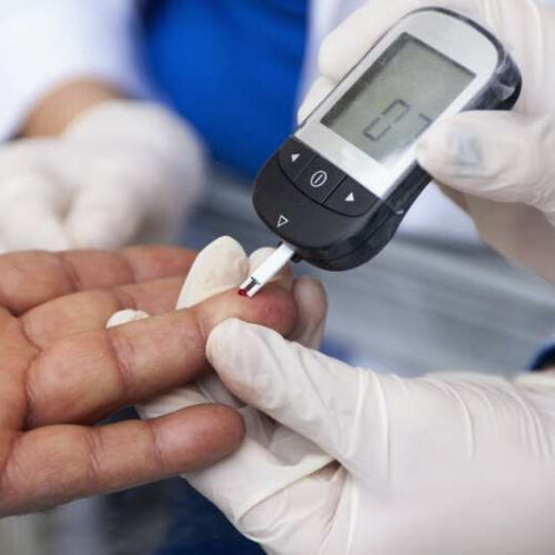 We’re on the hunt for novel ways to assess the risk of type 2 diabetes