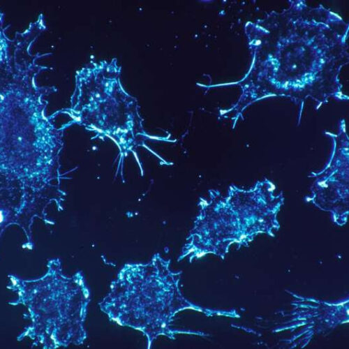 Scientists develop new class of cancer drug with potential to treat leukaemia