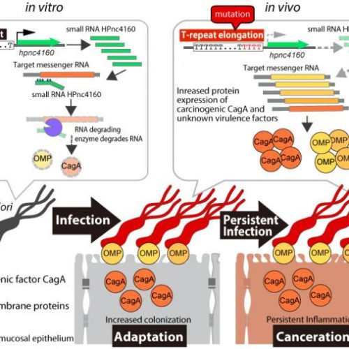 A tummy invader: This bacterial molecule may be key to fighting stomach cancer