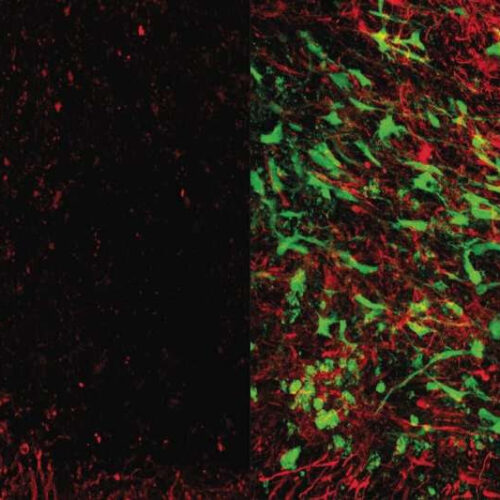 Stem cell therapy promotes recovery from stroke and dementia in mice