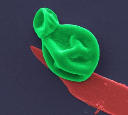 Superbug killer: New nanotech destroys bacteria and fungal cells