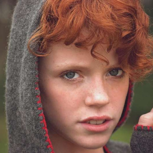 Research reveals why redheads may have different pain thresholds