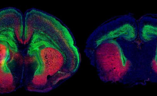 Mutations to Dyrk1a gene lead to brain undergrowth; an existing drug rescues the condition in newborn mice