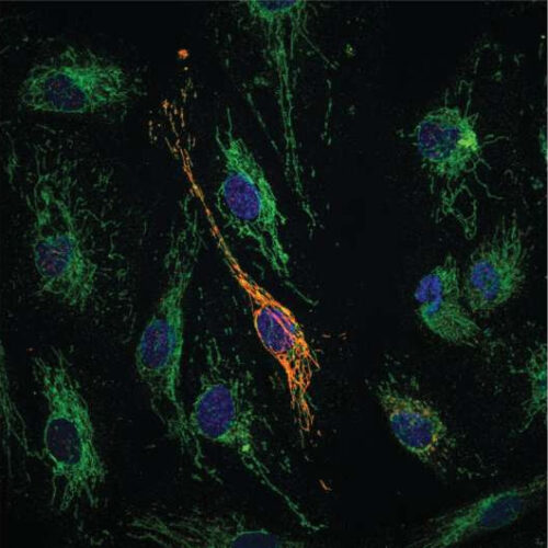 Newly-discovered molecule provides dual protection against vascular inflammation