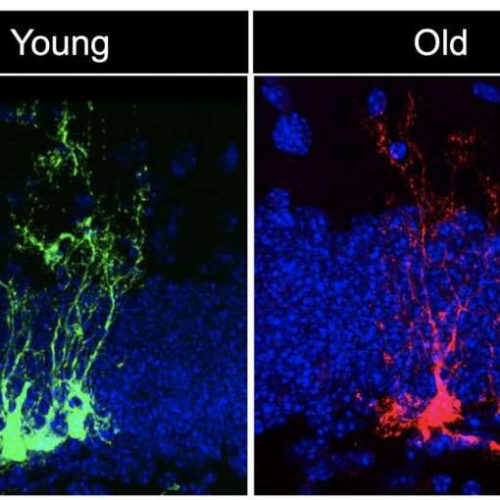 Study reveals neural stem cells age rapidly