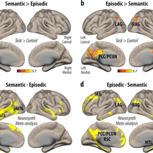 Knowing how the brain retrieves facts may help people with memory disorders