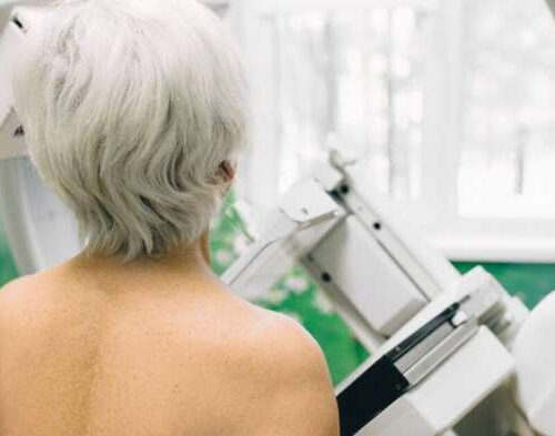 Reschedule your mammogram: COVID vaccine may lead to a harmless lump in your armpit