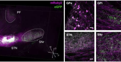 Study identifies two neuronal populations associated with symptoms of Parkinson’s disease