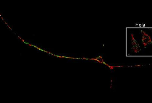 Interaction of mitochondria and lysosomes key in Parkinson’s disease