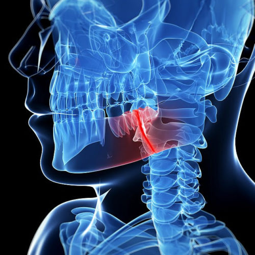 a landmark study has found that wo commonly used drugs not only halts bone deterioration but for more than half of patients reverses it