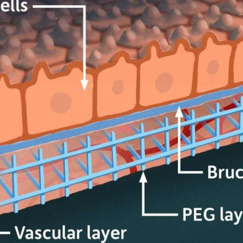 Lab model offers hope for macular degeneration patients