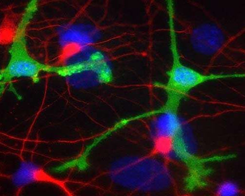 Experimental antibodies for Parkinson’s, Alzheimer’s may cause harmful inflammation