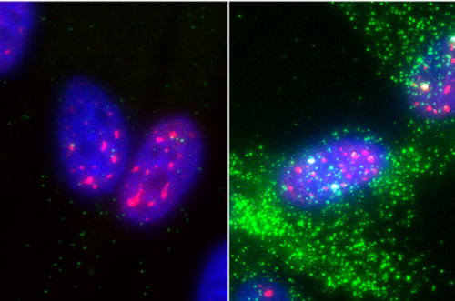 Mysterious “Nuclear Speckle” Structures Inside Cells Enhance Gene Activity, May Help Block Cancers