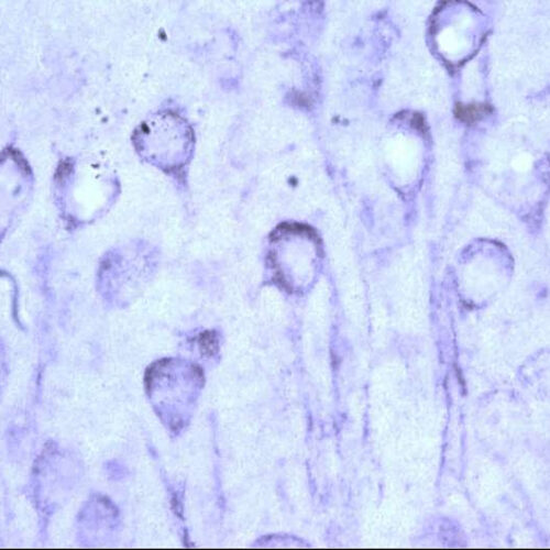 Chaperone protein imbalance promotes toxic tau buildup in the aging brain