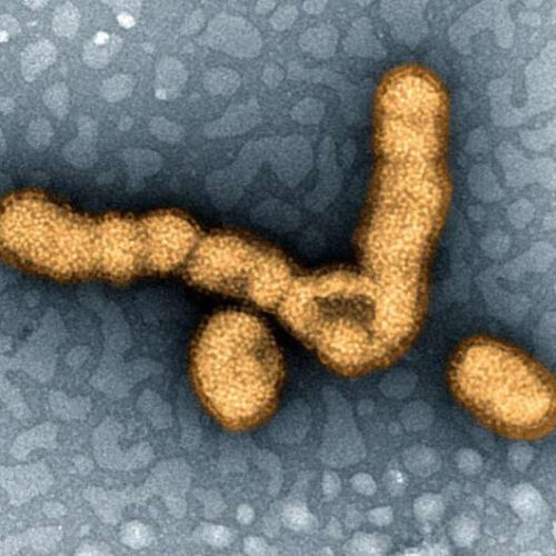 Researchers identify a novel autoantigen in narcolepsy, a mimic of a protein from swine flu virus