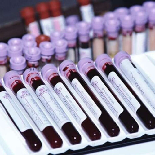 Study refutes theory that blood type affects COVID risk