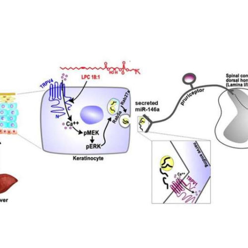 Maddening itch of liver disease comes from a surprising source