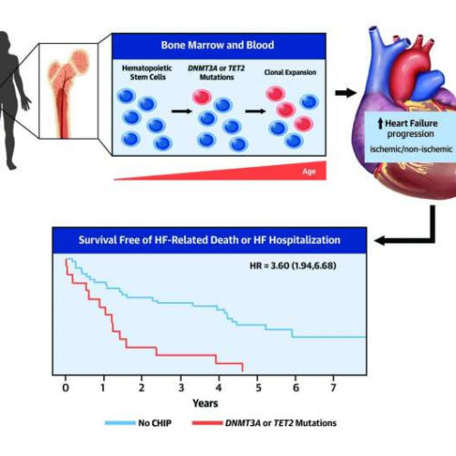 Identified: Mutations in blood cells that accelerate heart failure progression