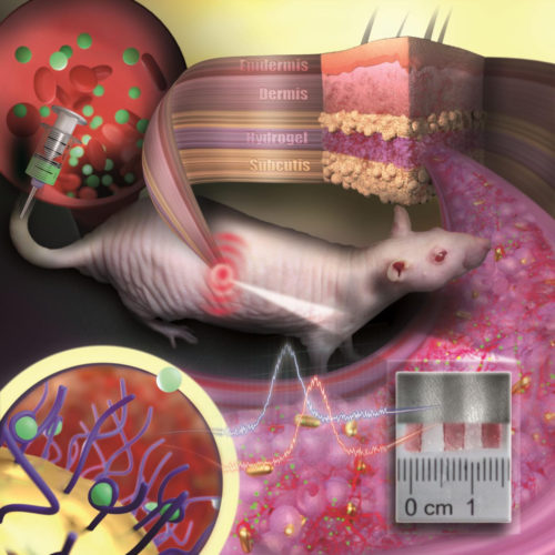 Tattoo made of gold nanoparticles revolutionizes medical diagnostics