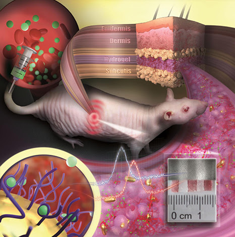 Gold Sensor Lives Under Skin for Months Measuring Drugs and Biomarkers