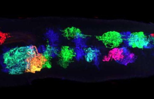 Researchers identify pathway that transitions brain from plasticity to stability