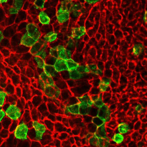 Brown fat cell discovery opens new doors for obesity treatment