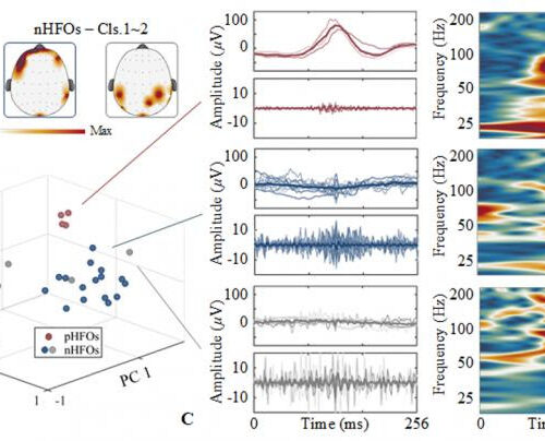 Fast brainwave oscillations identify and localize epileptic brain