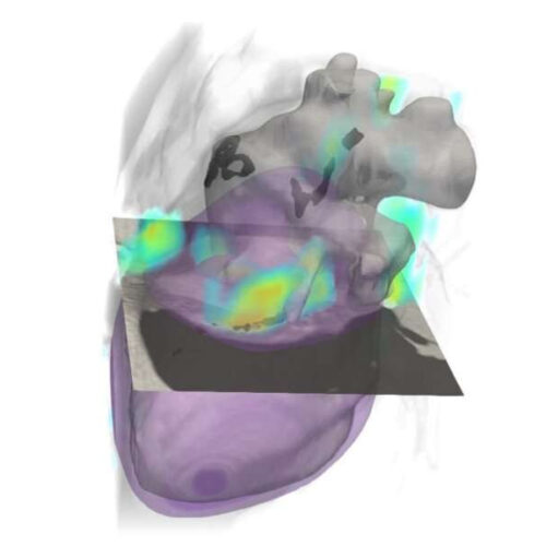 Deep learning enables dual screening for cancer and cardiovascular disease