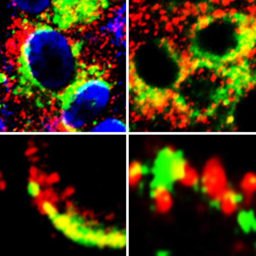 USC study reveals potential new treatment target in the fight against COVID-19