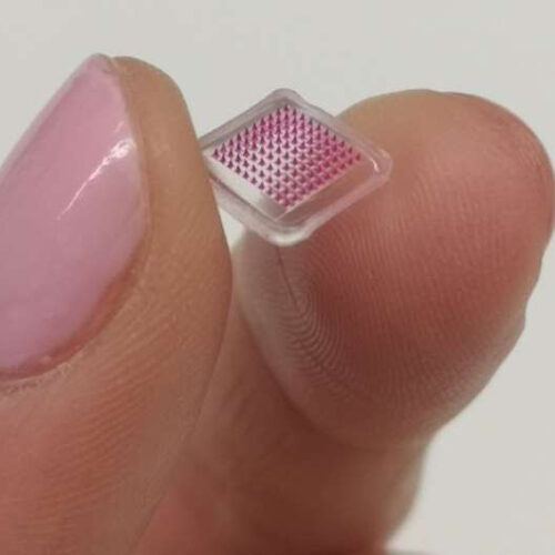 Microneedle patch delivers antibiotics locally in the skin