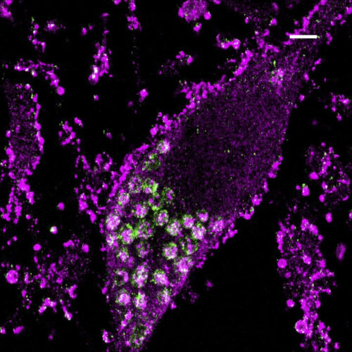 Full-genome CRISPR screen reveals surprising ways neurons survive oxidative stress