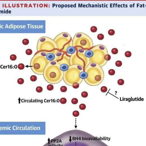 Weight-loss treatment prevents accumulation of lipid linked to cardiac mortality