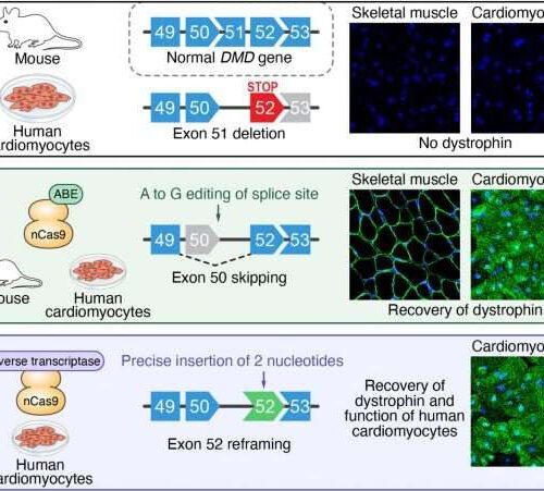 New gene editing strategies developed for Duchenne muscular dystrophy